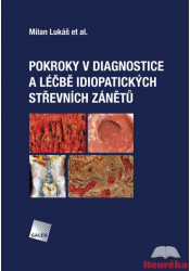 Pokroky v diagnostice a léčbě idiopatických střevních zánětů